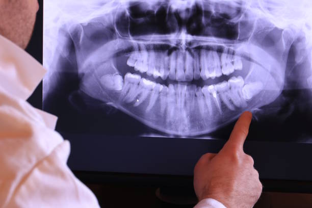 Best Weekend Emergency Dentist in East Bakersfield, CA