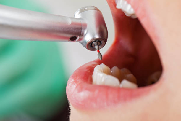 Best Same-Day Emergency Dental Services in East Bakersfield, CA